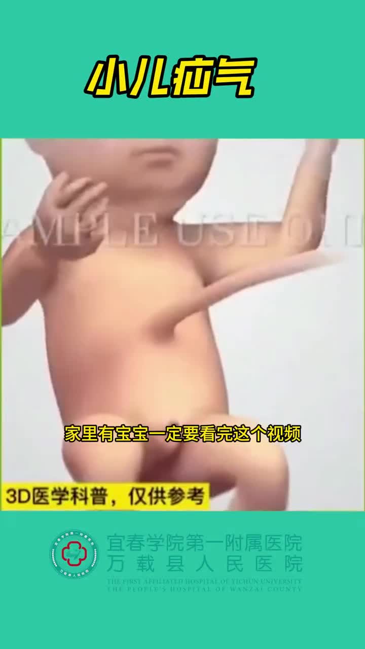 小儿疝气